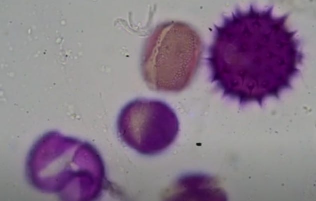 Microbia